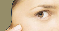 skin treatment
